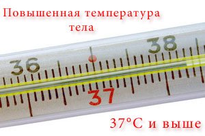 Температура тела: пониженная, нормальная и высокая